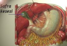 Safra Kesesi Alınmış Bir Kişi Hangi Besinleri Sindirmede Zorluk Çeker? safra kesesi